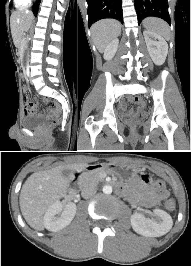 How to interpret abdomen CT scans: 3 Essential Methods