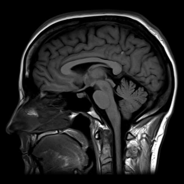 How to Interpret Brain MRIs: 3 Essential Techniques