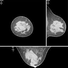 Wie man Brust-CT-Scans interpretiert: 3 essentielle Methoden
