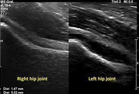 How to Interpret Joint Ultrasounds: 3 Essential Methods