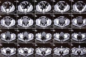 How to interpret pelvis CT scans: 3 Essential Methods