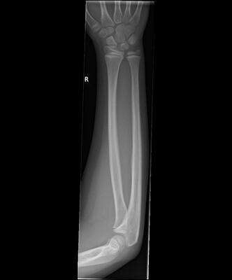 picture of a arm xray