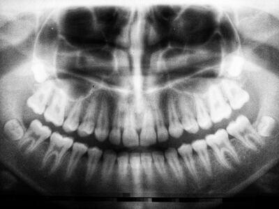 picture of a dental xray