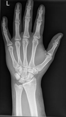picture of a hand xray