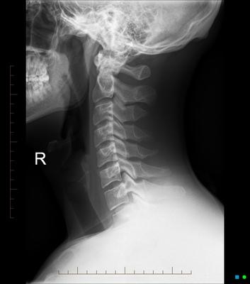 picture of a neck xray