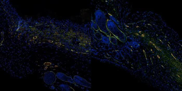 AI-Enhanced OCT Provides Real-Time Insight into Wound Healing