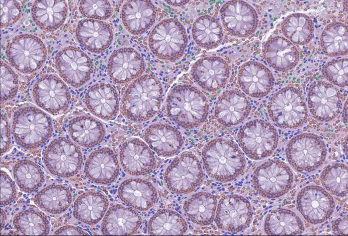 LazySlide: Open-Source AI Tool Advances Digital Pathology Analysis