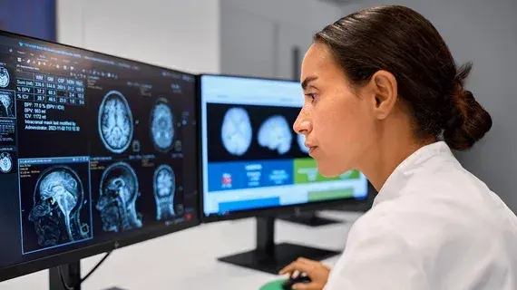 Medicare May Deny Coverage for AI-Based Brain MRI Tools