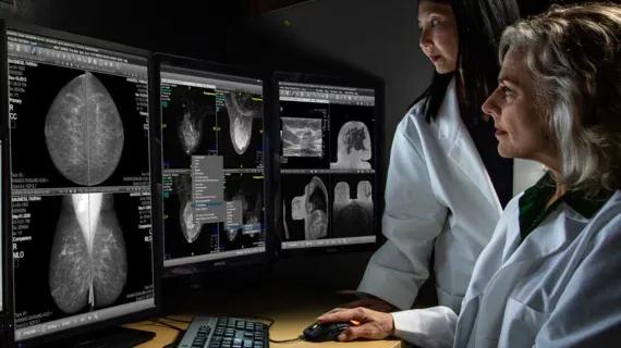 Real-World Study: AI Improves Breast Cancer Detection in 3D Mammography