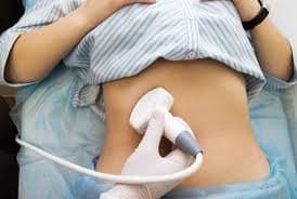Abdominal Ultrasound Procedure