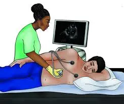 Example of an Echocardiogram Procedure