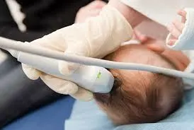 Procedimiento de Ultrasonido Craneal Neonatal