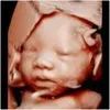 3DBabyVu
