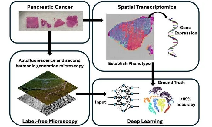 AI and Label-Free Microscopy Advance Pancreatic Cancer Phenotyping