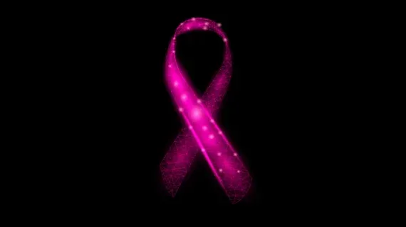 AI as Second Reader Surpasses Radiologists in Breast Cancer Screening