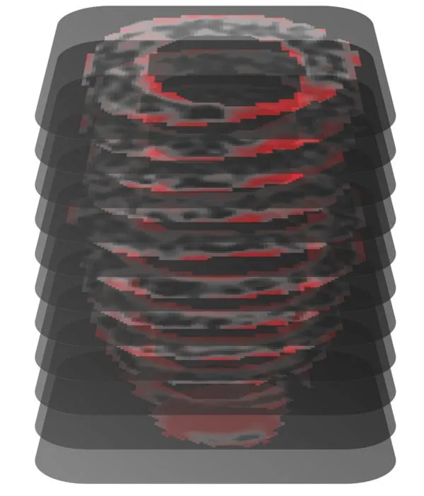 AI Outperforms Clinicians in Predicting Sudden Cardiac Death via MRI