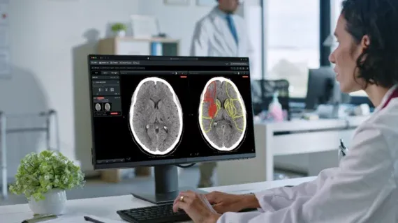 AI Platform Triples Functional Independence in UK Stroke Patients
