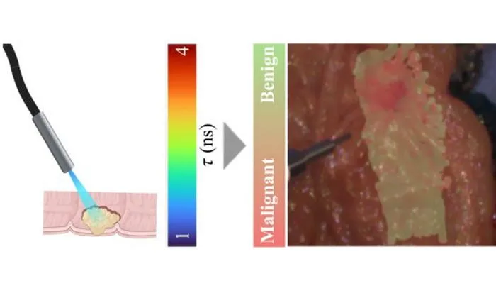 AI-Powered Optical Imaging Achieves High Accuracy for Colorectal Cancer Detection