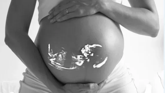AI-Powered Ultrasound Tool Predicts Delivery Timing for Pregnant Patients