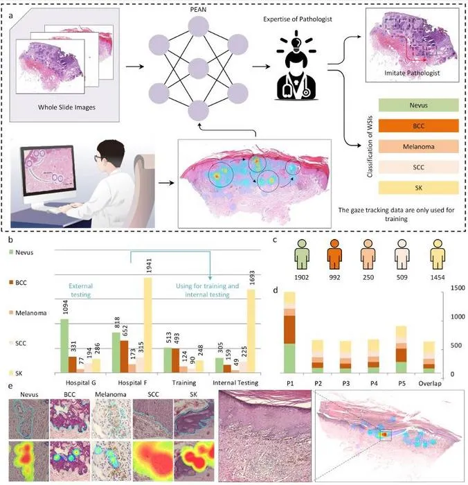 AI Trains on Pathologists’ Eye Movements to Improve Biopsy Analysis