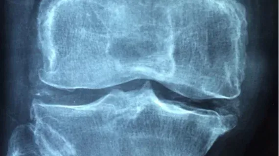 💡 Carebot LLM drafts reports for musculoskeletal X-rays