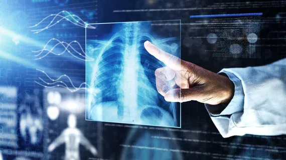 Generative AI Model Evaluated for Chest X-Ray TB Screening
