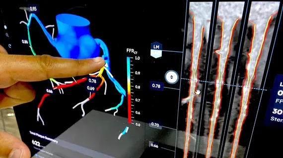 Heartflow AI Software Shows Major Impact on Cardiac Care Decisions