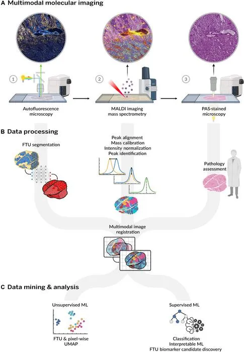 High-Resolution Kidney Lipid Atlas Uses Imaging AI for Disease Insights