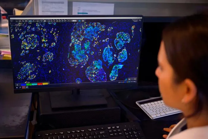 MSK Research: Proton Therapy, AI Pain Summaries, and Tumor Metastasis Insights