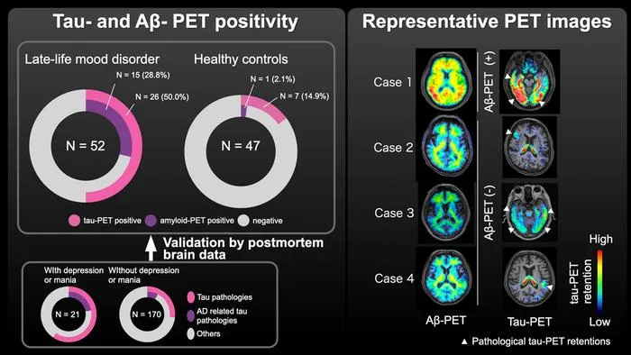 PET Imaging Links Late-Life Mood Disorders to Early Dementia Markers