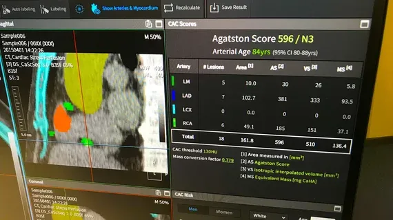Radiology Still Leads in FDA-Cleared Clinical AI Algorithms, Cardiology Follows