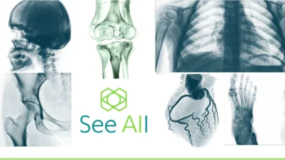 See All AI Raises $33M to Transform Intraoperative Imaging