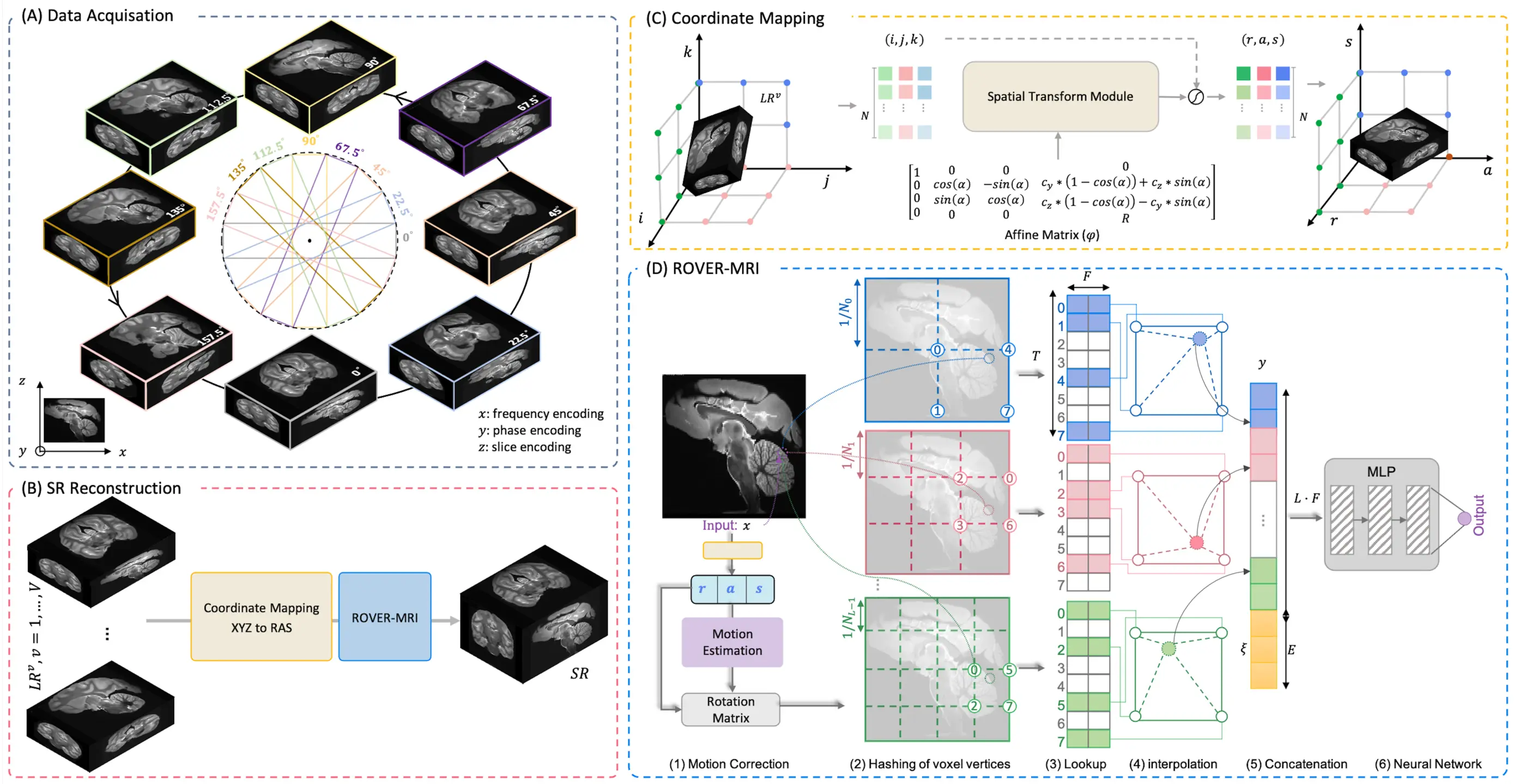 MRI innovation halves scan time for whole-brain imaging